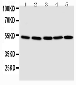 Anti-Smad1 antibody used in Western Blot (WB). GTX12344