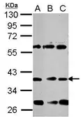 Anti-NeuroD1 antibody used in Western Blot (WB). GTX124268