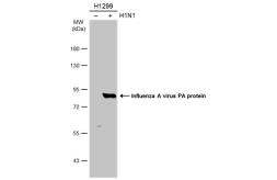 Influenza A Virus Pa Protein Antibody - 