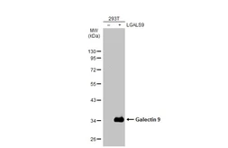 Anti-Galectin 9 antibody used in Western Blot (WB). GTX127353