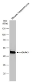 Anti-GAP43 antibody used in Western Blot (WB). GTX127937