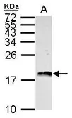 Anti-Histone H3 antibody used in Western Blot (WB). GTX127985