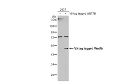 Anti-Wnt7b antibody used in Western Blot (WB). GTX128107