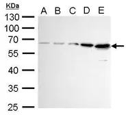 Anti-AKT antibody used in Western Blot (WB). GTX128415