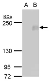 Anti-FIP200 antibody used in Western Blot (WB). GTX129094