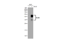 Anti-DLX2 antibody used in Western Blot (WB). GTX129123