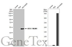 Anti-IRF4 / MUM1 antibody used in Western Blot (WB). GTX129135