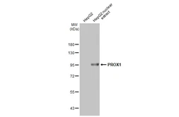 Anti-PROX1 antibody used in Western Blot (WB). GTX129143