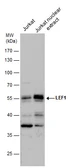 Anti-LEF1 antibody used in Western Blot (WB). GTX129186