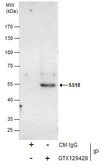 Anti-SS18 antibody used in Immunoprecipitation (IP). GTX129428