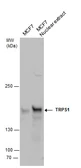 Anti-TRPS1 antibody used in Western Blot (WB). GTX129429