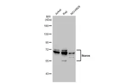Anti-Ikaros antibody used in Western Blot (WB). GTX129438