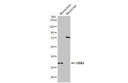 Anti-GBX2 antibody used in Western Blot (WB). GTX129494