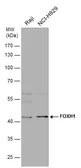 Anti-FOXH1 antibody used in Western Blot (WB). GTX129508