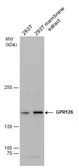 Anti-GPR126 antibody used in Western Blot (WB). GTX129821