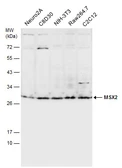 Anti-MSX2 antibody used in Western Blot (WB). GTX129870