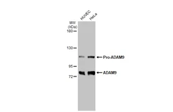 Anti-ADAM9 antibody used in Western Blot (WB). GTX130081