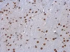Anti-SETD1A antibody used in IHC (Paraffin sections) (IHC-P). GTX130194