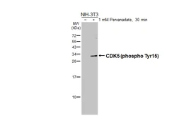 Anti-CDK5 (phospho Tyr15) antibody used in Western Blot (WB). GTX130416