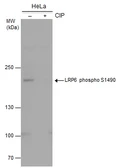 Anti-LRP6 (phospho Ser1490) antibody used in Western Blot (WB). GTX130421