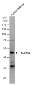 Anti-SLC7A9 antibody used in Western Blot (WB). GTX130516