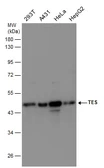 Anti-TES antibody used in Western Blot (WB). GTX130661