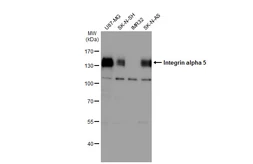 Anti-Integrin alpha 5 antibody used in Western Blot (WB). GTX130705
