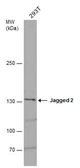 Anti-Jagged 2 antibody used in Western Blot (WB). GTX130743