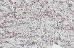 Anti-Jagged 2 antibody used in IHC (Paraffin sections) (IHC-P). GTX130743