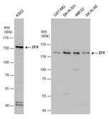 Anti-ZFX antibody used in Western Blot (WB). GTX130761