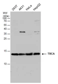 Anti-TBCA antibody used in Western Blot (WB). GTX130832