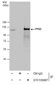 Anti-PYK2 antibody used in Immunoprecipitation (IP). GTX130887