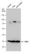 Anti-DND1 antibody used in Western Blot (WB). GTX130960