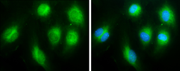 Anti-Thrombospondin 1 antibody used in Immunocytochemistry/ Immunofluorescence (ICC/IF). GTX130967