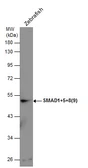 Anti-SMAD1+5+8(9) antibody used in Western Blot (WB). GTX131100