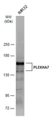 Anti-PLEKHA7 antibody used in Western Blot (WB). GTX131146