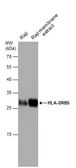 Anti-HLA-DRB5 antibody used in Western Blot (WB). GTX131196