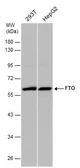 Anti-FTO antibody used in Western Blot (WB). GTX131517