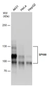 Anti-SP100 antibody used in Western Blot (WB). GTX131570