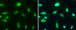 Anti-CHD3 antibody used in Immunocytochemistry/ Immunofluorescence (ICC/IF). GTX131779