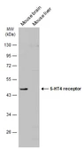 Anti-5-HT4 receptor antibody used in Western Blot (WB). GTX131835
