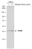 Anti-NMBR antibody used in Western Blot (WB). GTX131894