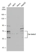 Anti-Cav beta 2 antibody used in Western Blot (WB). GTX131906