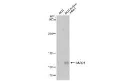 Anti-BARD1 antibody used in Western Blot (WB). GTX132094