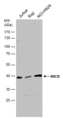 Anti-MICB antibody used in Western Blot (WB). GTX132112