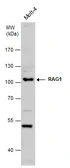 Anti-RAG1 antibody used in Western Blot (WB). GTX132124