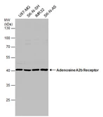 Anti-Adenosine A2b Receptor antibody used in Western Blot (WB). GTX132217