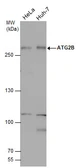 Anti-ATG2B antibody used in Western Blot (WB). GTX132307