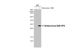 Anti-Enterovirus D68 VP2 antibody used in Western Blot (WB). GTX132314