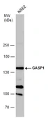 Anti-GASP1 antibody used in Western Blot (WB). GTX132469